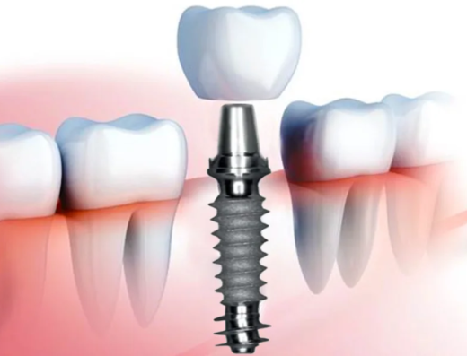 Dent Essence Pro Advanced Dental Care