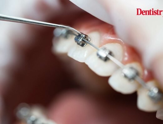 Dent Essence Pro Advanced Dental Care